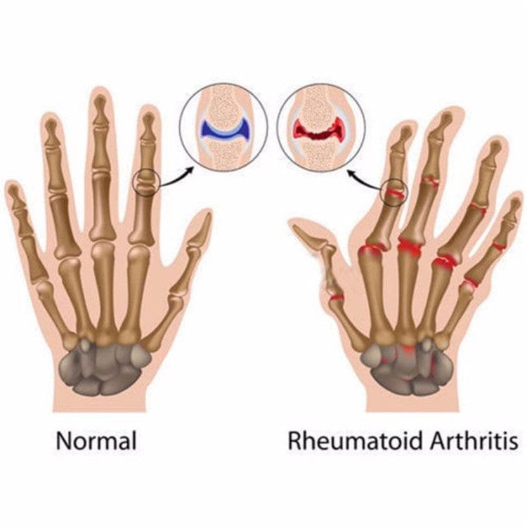 Allrj Copper Infused Hand Gloves - ALLRJ