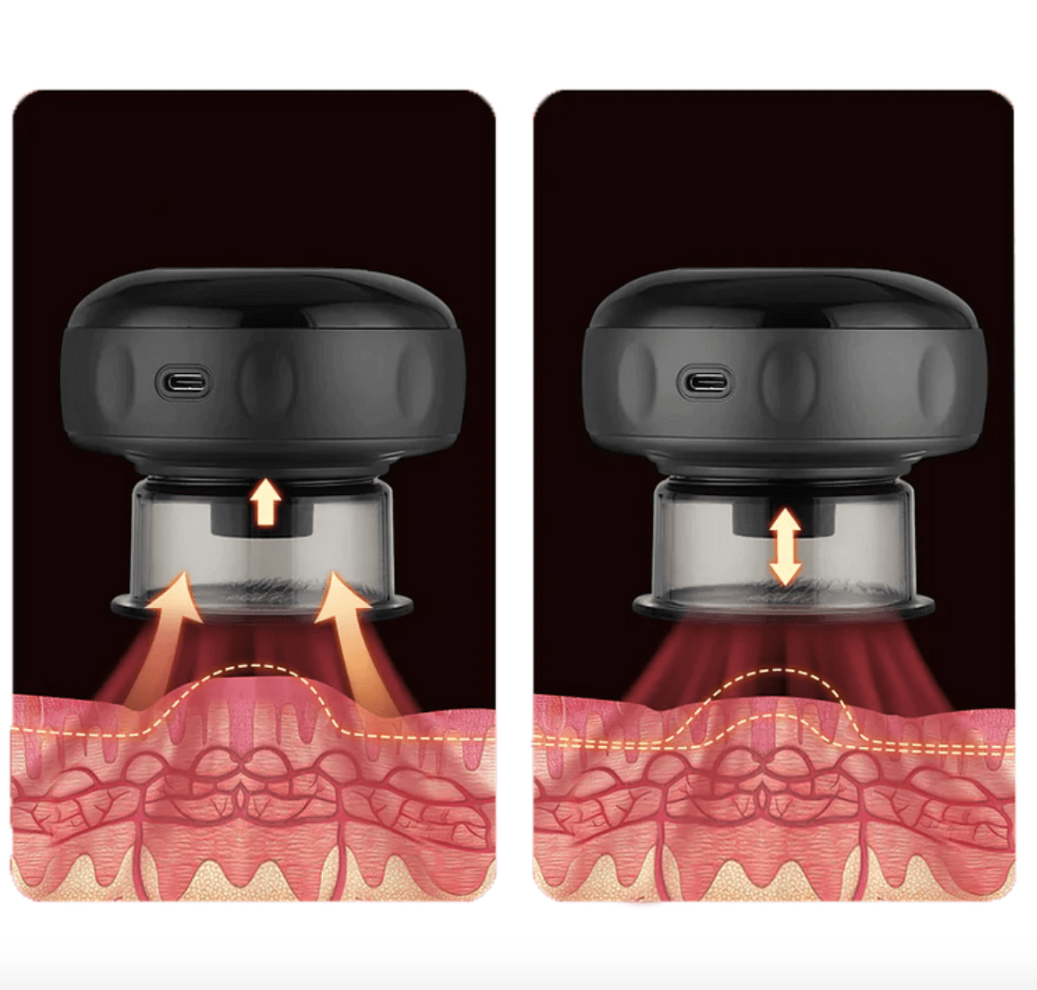 Allrj Smart Cupper 2.0 - ALLRJ