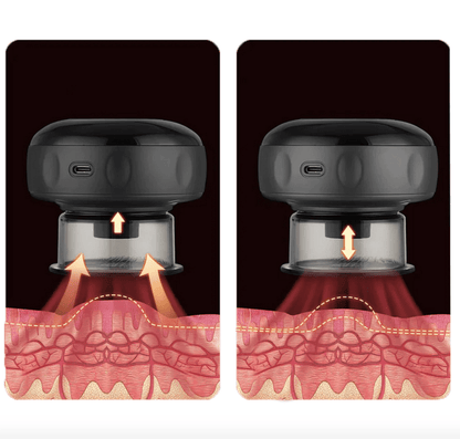 Allrj Smart Cupper 2.0 - ALLRJ