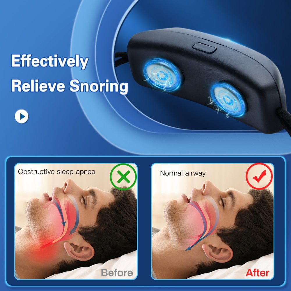 SleepRex II Smart Anti Snoring Apnea Device - ALLRJ